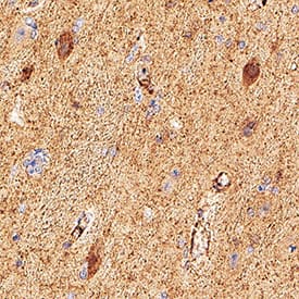  beta -Synuclein was detected in immersion fixed paraffin-embedded sections of Human Hippocampus using Mouse Anti-Human  beta -Synuclein Monoclonal Antibody (Catalog # MAB5528) at 15 µg/mL for 1 hour at room temperature followed by incubation with the Anti-Mouse IgG VisUCyte™ HRP Polymer Antibody (Catalog # VC001). Before incubation with the primary antibody, tissue was subjected to heat-induced epitope retrieval using VisUCyte Antigen Retrieval Reagent-Basic (Catalog # VCTS021). Tissue was stained using DAB (brown) and counterstained with hematoxylin (blue). Specific staining was localized to neurons. View our protocol for IHC Staining with VisUCyte HRP Polymer Detection Reagents.