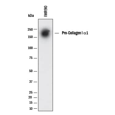 Western blot shows lysates of IMR‑90 human lung fibroblast cell line. PVDF membrane was probed with 1 µg/mL of Mouse Anti-Human N-Pro Collagen I Monoclonal Antibody (Catalog # MAB6220) followed by HRP-conjugated Anti-Mouse IgG Secondary Antibody (HAF018). A specific band was detected for Collagen I at approximately 170 kDa (as indicated). This experiment was conducted under reducing conditions and using Western Blot Buffer Group 1.