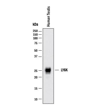 Western blot shows lysates of human Testes. PVDF membrane was probed with 2 µg/mL of Mouse Anti-Human Ly6K Monoclonal Antibody (Catalog # MAB66481) followed by HRP-conjugated Anti-Mouse IgG Secondary Antibody (Catalog # HAF018). A specific band was detected for Ly6K at approximately 26 kDa (as indicated). This experiment was conducted under reducing conditions and using Western Blot Buffer Group 1.