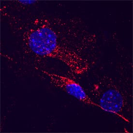 FIH-1/HIF-1AN was detected in immersion fixed C2C12 mouse myoblast cell line using Mouse Anti-Human/Mouse FIH-1/HIF-1AN Monoclonal Antibody (Catalog # MAB7874) at 25 µg/mL for 3 hours at room temperature. Cells were stained using the NorthernLights™ 557-conjugated Anti-Mouse IgG Secondary Antibody (red; NL007) and counterstained with DAPI (blue). Specific staining was localized to cytoplasm. Staining was performed using our protocol for Fluorescent ICC Staining of Non-adherent Cells.