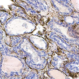 Nephronectin was detected in immersion fixed frozen sections of human thyroid using Mouse Anti-Human Nephronectin Monoclonal Antibody (Catalog # MAB8025) at 1.7 µg/mL for 1 hour at room temperature followed by incubation with the Anti-Mouse IgG VisUCyte™ HRP Polymer Antibody (VC001). Before incubation with the primary antibody, tissue was subjected to heat-induced epitope retrieval using Antigen Retrieval Reagent-Basic (CTS013). Tissue was stained using DAB (brown) and counterstained with hematoxylin (blue). Specific staining was localized to extracelluar connective tissue. Staining was performed using our protocol for IHC Staining with VisUCyte HRP Polymer Detection Reagents.