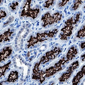 ACE‑2 was detected in immersion fixed paraffin-embedded sections of human kidney using Mouse Anti-Human ACE‑2 Monoclonal Antibody (Catalog # MAB9335) at 5 µg/mL for 1 hour at room temperature followed by incubation with the Anti-Mouse IgG VisUCyte™ HRP Polymer Antibody (VC001). Before incubation with the primary antibody, tissue was subjected to heat-induced epitope retrieval using Antigen Retrieval Reagent-Basic (CTS013). Tissue was stained using DAB (brown) and counterstained with hematoxylin (blue). Specific staining was localized to cell membrane in convoluted tubules. Staining was performed using our protocol for IHC Staining with VisUCyte HRP Polymer Detection Reagents.