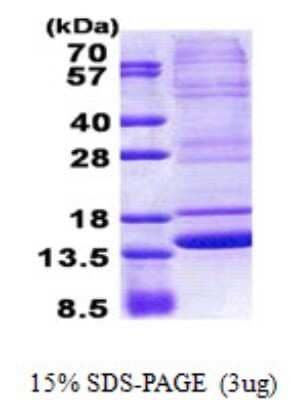 Recombinant Human Neuromedin B His Protein (NBP2-23280): Novus Biologicals