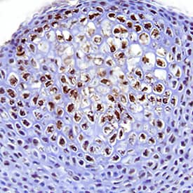 p38 was detected in immersion fixed frozen sections of mouse embryo (13 d.p.c.) using Rabbit Anti-Human/Mouse/Rat Phospho-p38 MAP Kinase (T180/Y182) Antigen Affinity-purified Polyclonal Antibody (Catalog # AF869) at 15 µg/mL overnight at 4 °C. Tissue was stained using the Anti-Rabbit HRP-DAB Cell & Tissue Staining Kit (brown; Catalog # CTS005) and counterstained with hematoxylin (blue). Specific staining was localized to developing cartilage. View our protocol for Chromogenic IHC Staining of Frozen Tissue Sections.