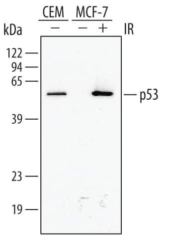 Western blot shows lysates of CEM human T‑lymphoblastoid cell line and MCF‑7 human breast cancer cell line untreated (-) or treated (+) with 10 Gy ionizing radiation (IR) for 1 hour. PVDF membrane was probed with 1:5000 dilution of Human/Mouse/Rat p53 HRP-conjugated Antigen Affinity-purified Polyclonal Antibody (Catalog # HAF1355). A specific band was detected for p53 at approximately 53 kDa (as indicated). This experiment was conducted under reducing conditions and using Immunoblot Buffer Group 1.