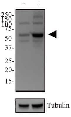 Western Blot: p62/SQSTM1 Antibody [NBP1-48320] - Cultured HeLa cells were treated with or without 50 uM chloriquine for 24 hours as indicated.  Cell lysates were prepared and separated on a 12% gel by SDS-PAGE.  Protein was transferred to PVDF membrane and blocked in 5% non-fat milk.  The membrane was then probed with 1 ug/ml anti-p62/SQSMT1 in 1% milk and dectected with an anti-rabbit HRP secondary antibody using chemiluminescence.  Note the upregulation of p62 (arrowhead) in response to chloroquine treatment and the blockage of autophagy.