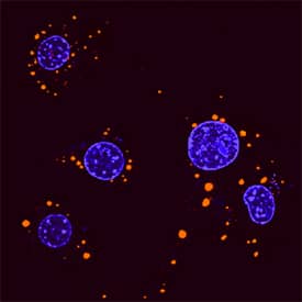 p62/SQSTM1 was detected in formaldehyde fixed RAW 264.7 mouse monocyte/macrophage cell line treated with LPS using Mouse Anti-Human/Mouse/Rat p62/SQSTM1 Biotinylated Monoclonal Antibody (Catalog # BAM8028) at 8 µg/mL overnight at 4 °C. Cells were stained using the NorthernLights™ 557-conjugated Streptavidin (orange; Catalog # NL999) and counterstained with DAPI (blue). Specific staining was localized to autophagosomes. View our protocol for Fluorescent ICC Staining of Cells on Coverslips.