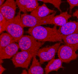 p70 S6 Kinase  beta  was detected in immersion fixed MCF-7 human breast cancer cell line using Goat Anti-Human p70 S6 Kinase  beta  Antigen Affinity-purified Polyclonal Antibody (Catalog # AF2987) at 10 µg/mL for 3 hours at room temperature. Cells were stained using the NorthernLights™ 557-conjugated Anti-Goat IgG Secondary Antibody (red; Catalog # NL001) and counterstained with DAPI (blue). Specific staining was localized to cytoplasm and nuclei. View our protocol for Fluorescent ICC Staining of Cells on Coverslips.