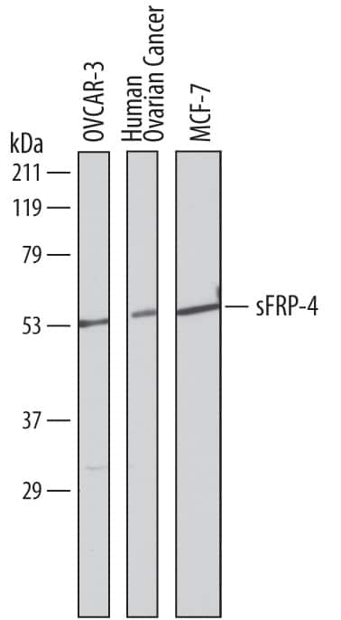 Western blot shows lysates of OVCAR-3 human ovarian carcinoma cell line, human ovarian cancer tissue, and MCF-7 human breast cancer cell line. PVDF membrane was probed with 2 µg/mL of Goat Anti-Human sFRP-4 Antigen Affinity-purified Polyclonal Antibody (Catalog # AF1827) followed by HRP-conjugated Anti-Goat IgG Secondary Antibody (Catalog # HAF019). A specific band was detected for sFRP-4 at approximately 53-55 kDa (as indicated). This experiment was conducted under reducing conditions and using Immunoblot Buffer Group 8.