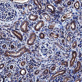 sFRP‑1 was detected in immersion fixed paraffin-embedded sections of human kidney using Goat Anti-Human sFRP‑1 Antigen Affinity-purified Polyclonal Antibody (Catalog # AF1384) at 1 µg/mL overnight at 4 °C. Tissue was stained using the Anti-Goat HRP-DAB Cell & Tissue Staining Kit (brown; Catalog # CTS008) and counterstained with hematoxylin (blue). Specific staining was localized to epithelial cell cytoplasm in convoluted tubules. View our protocol for Chromogenic IHC Staining of Paraffin-embedded Tissue Sections.