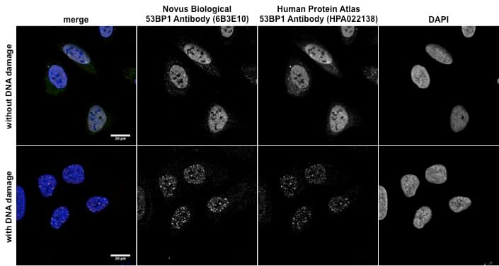 DNA / SCATTER THE BRAIN ジャパメタ VIRUS Mutations in ANKLE2, a ZIKA Virus Target, Disrupt an