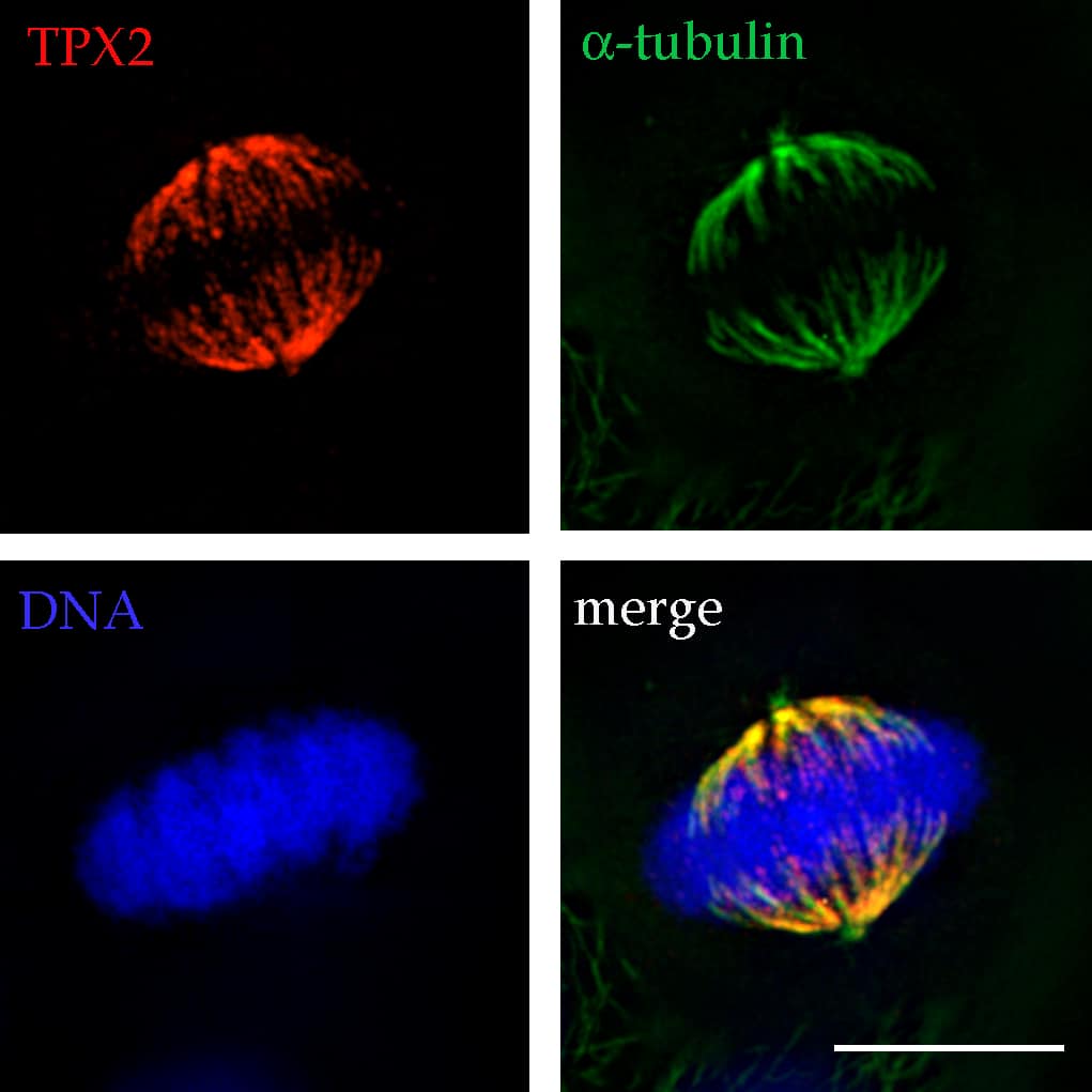 Stapes morphology (based on Hydropotes inermis NMB 9892). (A