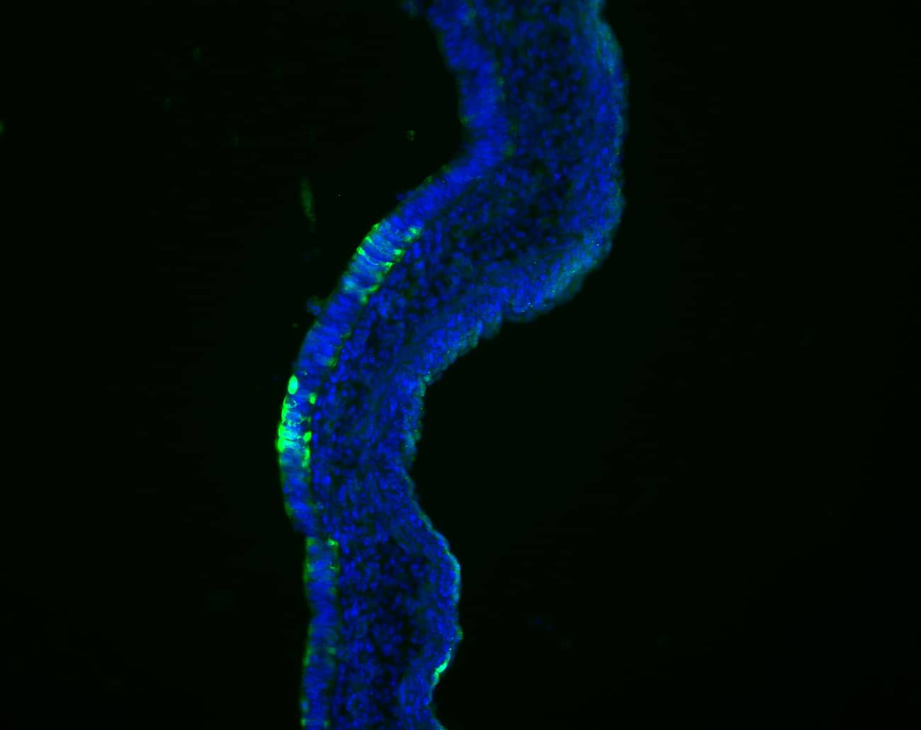 beta Galactosidase Antibody (NB100-2045): Novus Biologicals