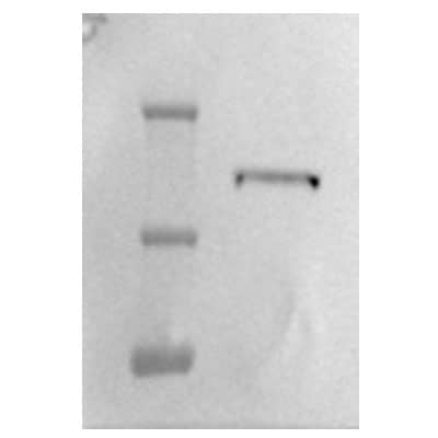 Integrin alpha 2/CD49b Antibody (EPR5788) (NBP1-96715): Novus Biologicals