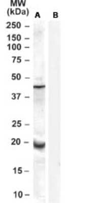 glutathione peroxidase 7 Glutathione Peroxidase 7 Antibody
